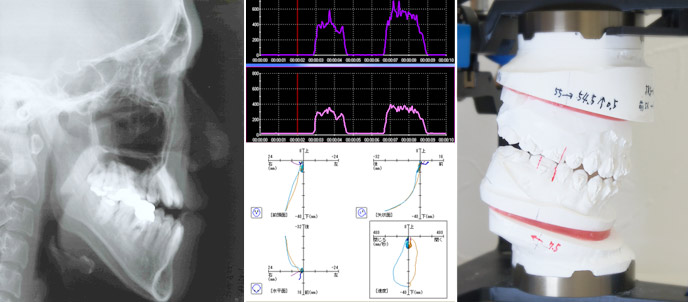 顎変形症・先天異常に伴う不正咬合